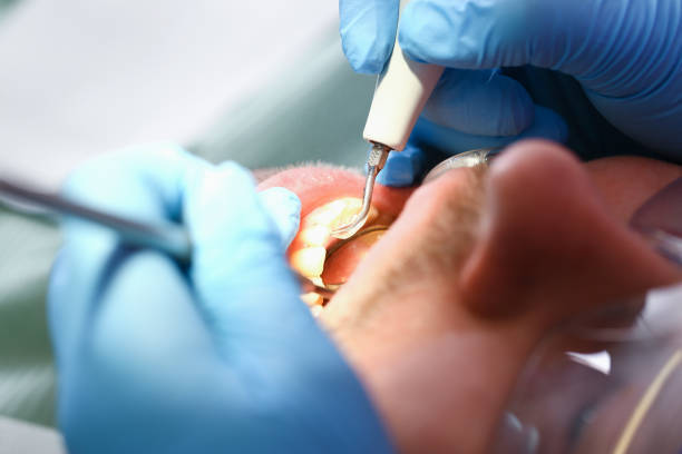 Best Emergency Treatment for Toothache in Coushatta, LA
