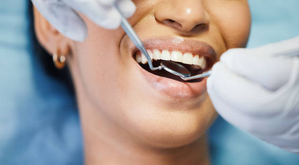 Best Emergency Treatment for Toothache in Coushatta, LA